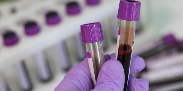 A person wearing PPE holds 2 test tubes which have blood samples in them, in a lab.