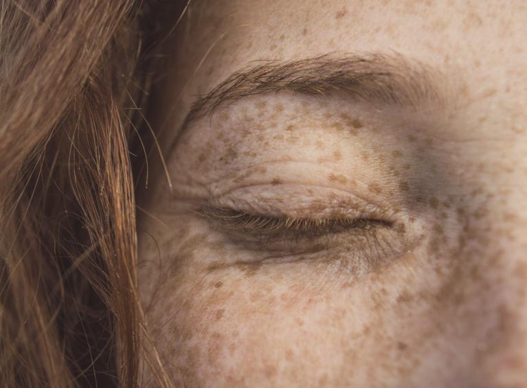 A close up of person's face; their eyes are closed and they have freckles and ginger hair.