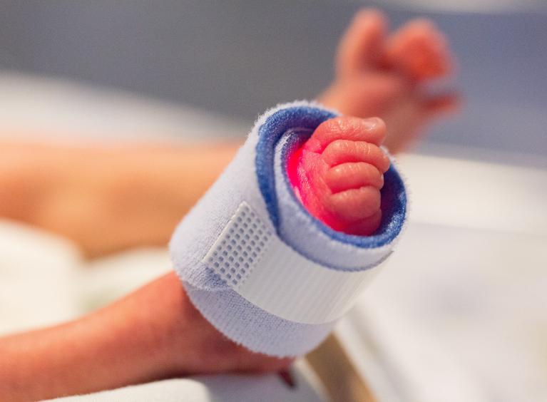 A close-up of a premature baby's legs and feet, with a bandage wrapped around one foot.