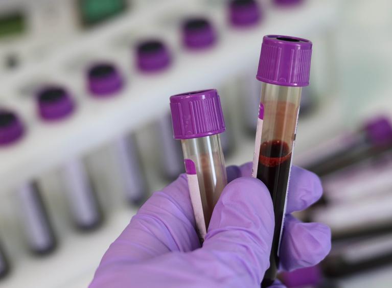 A person wearing PPE holds 2 test tubes which have blood samples in them, in a lab.