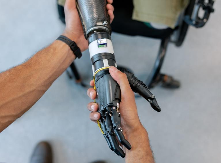 A person who has had both their legs and arms amputated, sits in a wheelchair whilst a prosthetic arm is fitted.