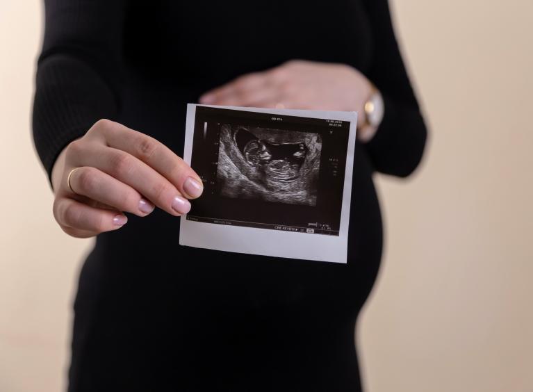 A pregnant person holds up an image taken via an ultrasound scan.