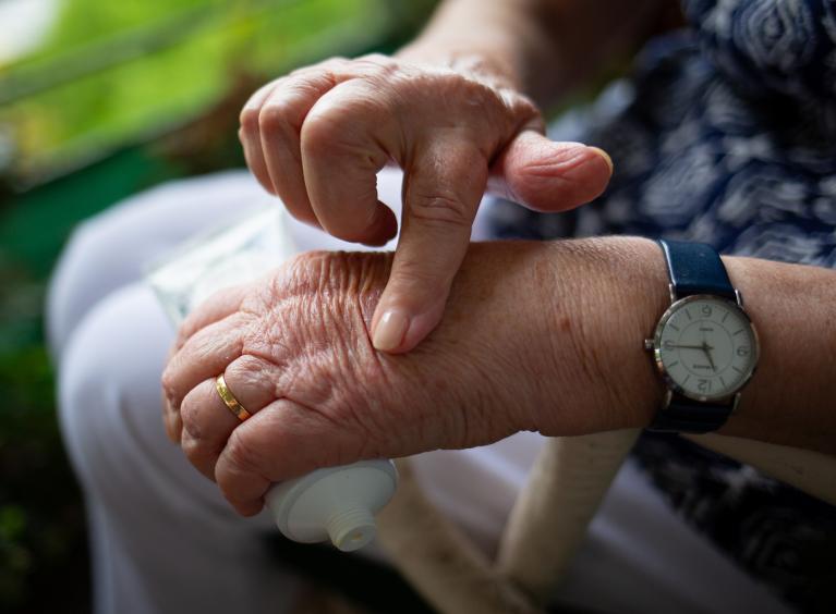 An older person rubs cream onto their hands, to help with joint pain.