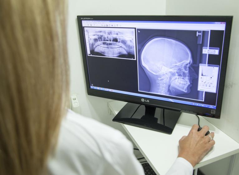 A doctor inspects x-rays of a person's jaw.