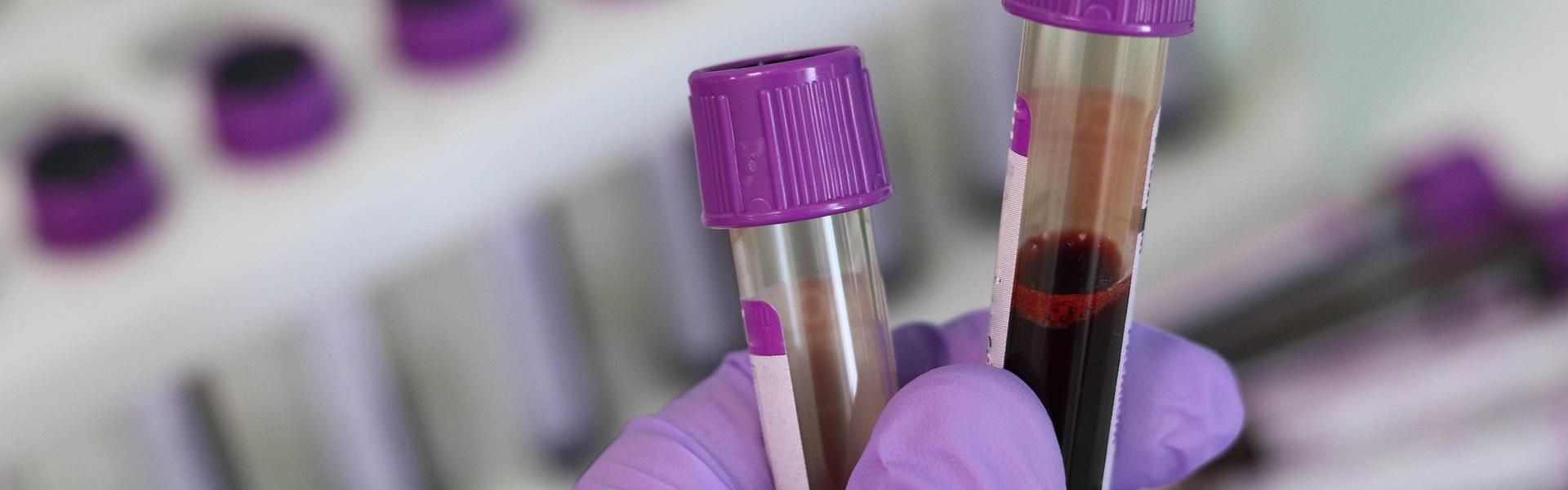 A person wearing PPE holds 2 test tubes which have blood samples in them, in a lab.