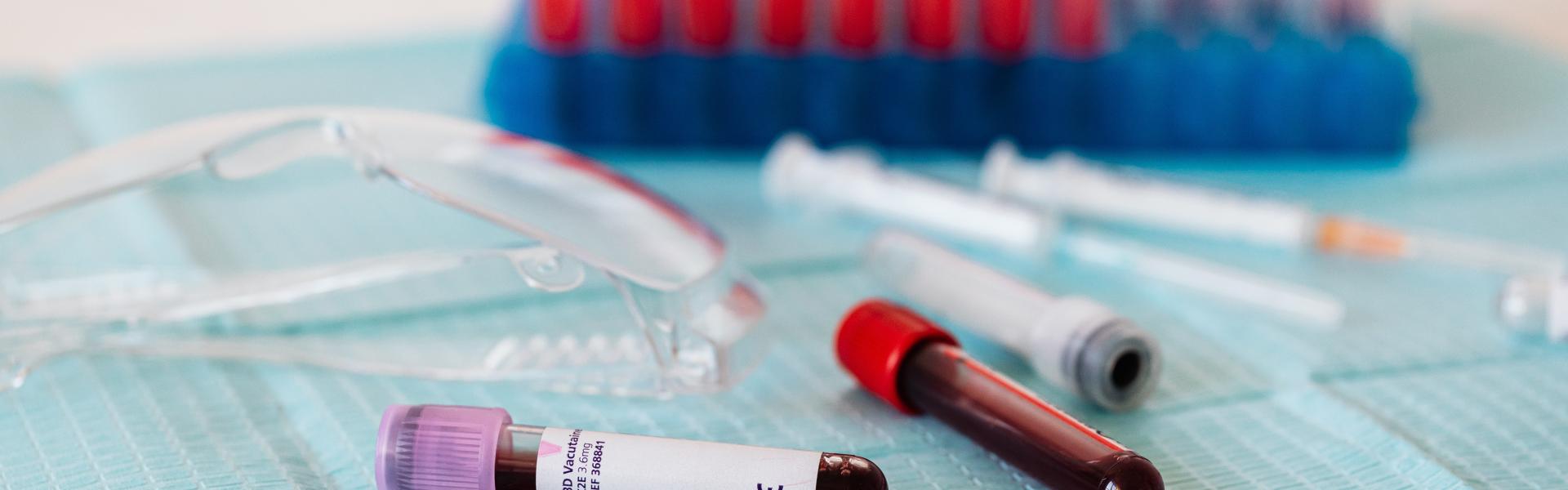 two vials of blood laying on a table